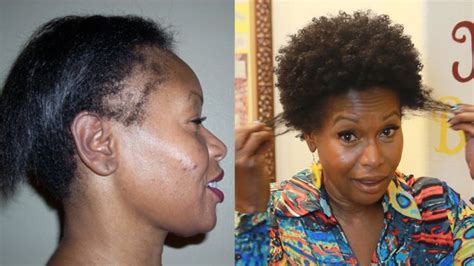 how i repaired my thinning edges 2 products [video videos products and natural hair care tips