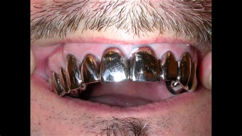 full metal mouth white gold crowns teeth  steel grillz youtube