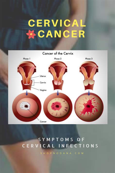symptoms of cervical infections and cancer know about your