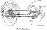 Nasal Sinus Cavity Paranasal Cancer Sinuses Surgery Mskcc Maxillary Node Symptoms Identify sketch template