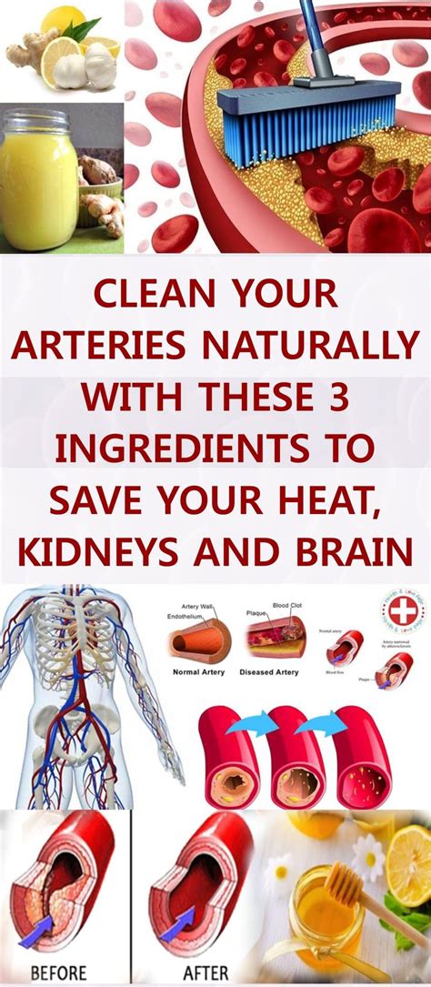 fine article    clean  arteries naturally