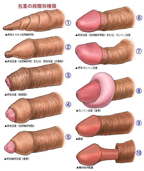 different penis types chart —