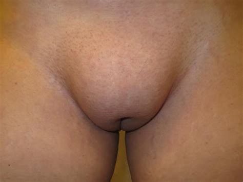bald pussy mound in hard sex