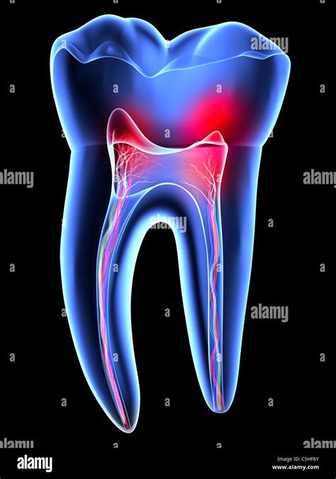 tooth pain toothache stock photo alamy