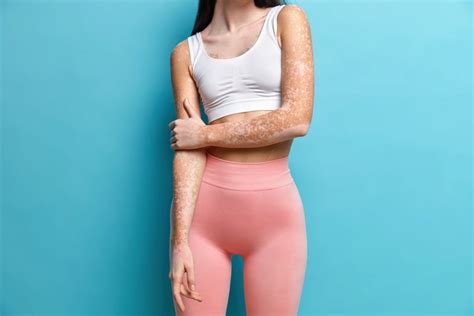 Striving For A Thigh Gap How Coolsculpting Can Help Davinci Body