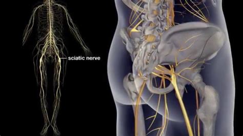 sciatic nerve  sciatic pain relief treatment sciatic