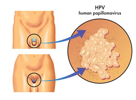 common std symptoms in men std testing in fresno