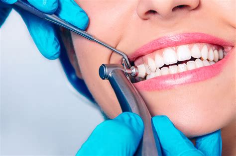 healthfeature six benefits of getting a dental cleaning cnw network