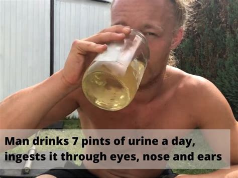 Man Drinks Urine Man Drinks 7 Pints Of His Urine A Day Ingests It