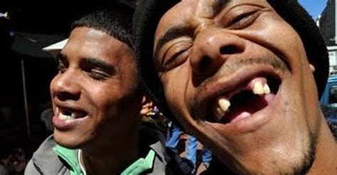 Cape Coloured People Pull Their Front Teeth For Fashion