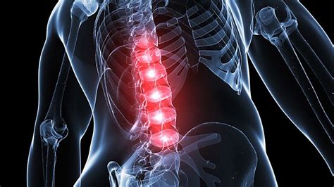 Steroid Shots May Not Help Back Pain Everyday Health