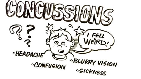 concussions 101 management using chiropractic care physiotherapy and