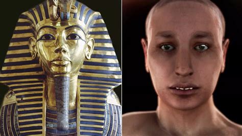 tutankhamun had club foot and was the product of incest according to