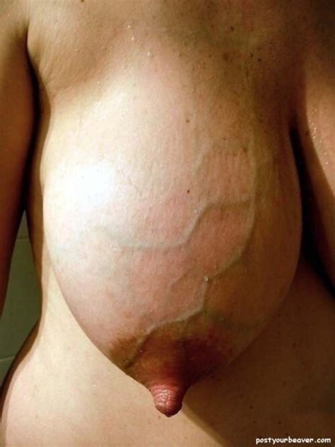 engorged veiny breasts huge tits datawav
