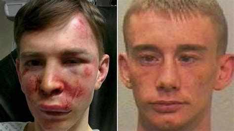 andrew thornton attack liam chisholm jailed for callous attack on