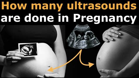 how many ultrasounds are done in pregnancy normally first and second