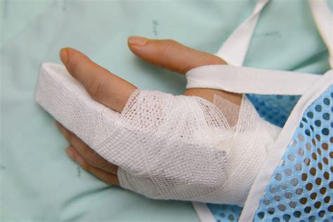 treat  broken finger  pro orthopedics sports medicine