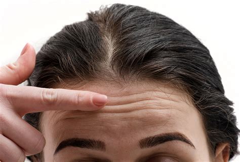 reasons  forehead wrinkles treatment options