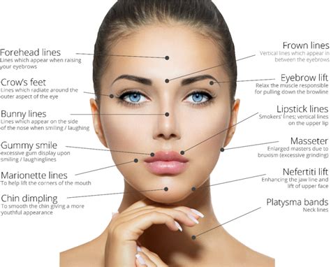 anti wrinkle injections