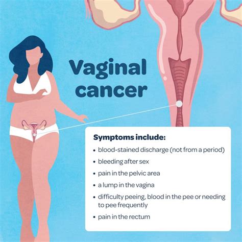 what is gynaecological cancer and what are the symptoms