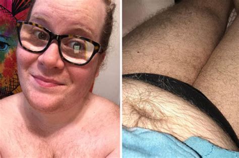 Polycystic Ovary Syndrome Sufferer Embraces Body And