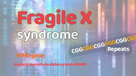 Fragile X Syndrome Genetic Disorders Fmr1 Gene Cgg Repeats Fmrp