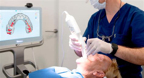 El Escáner Intraoral Itero A Tu Servicio Alaia Centro Odontológico