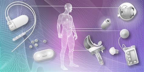 smart implants  surgery ieee life sciences