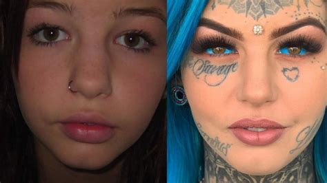 ‘dragon Girl’ Goes Blind Tattooing Eyeballs Blue The Advertiser