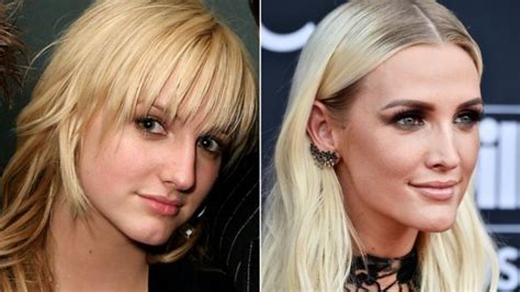 celebs who lied about never having plastic surgery