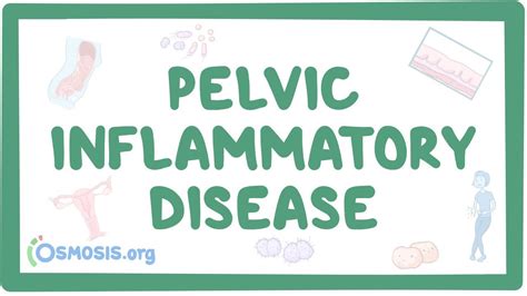 Pelvic Inflammatory Disease Osmosis