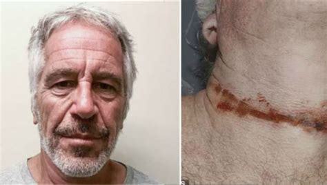 epstein photos spark new theories about how he was killed