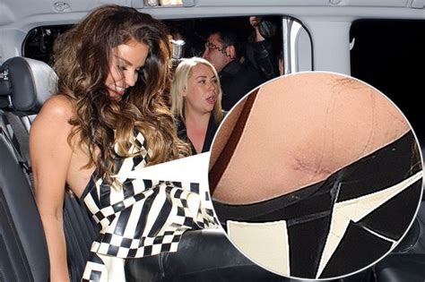 Katie Price Flashes Boob Reduction Surgery Scar As