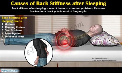 Causes Of Back Stiffness After Sleeping And Its Treatment