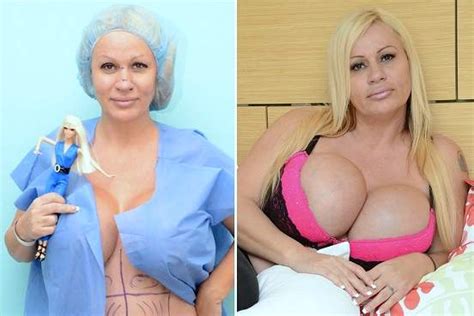 lacey wildd plastic surgery before and after photos