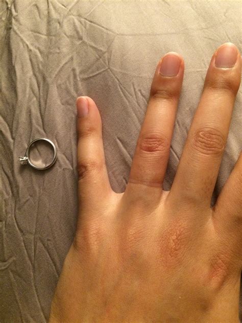 sizing is hard does your ring leave an indent mark tapered fingers