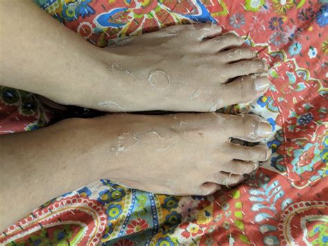 i tried this trending korean foot peel that takes 2 weeks to come off so you don t have to