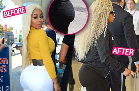 Total Bummer Blac Chyna S Booty Is Deflating