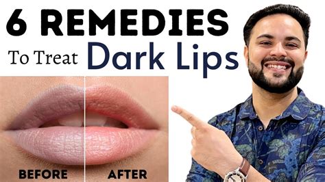dark lips treatment diy 6 home remedies youtube