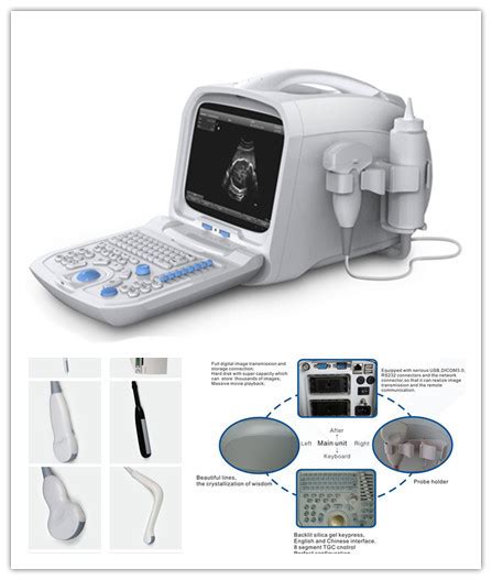 portable ultrasound machine   price  chengdu sichuan sichuan