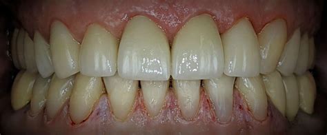 garland grove dentistry smile gallery images smile restoration