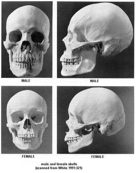 33 Best Anatomy M F Skulls Images On Pinterest