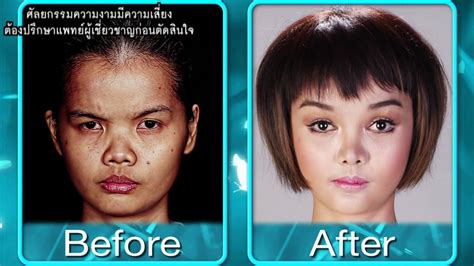 Photos Korean Surgery Show Gives Thai Girl ‘barbie