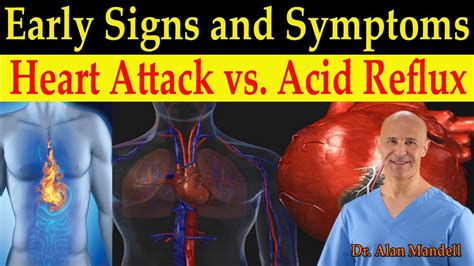 Identifying Heart Attack Vs Acid Reflux Gerd Early Warning Signs