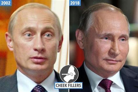 Plastic Surgeon Claims Putin Had These Surgeries Demotix