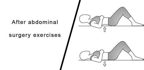 abdominal surgery exercises