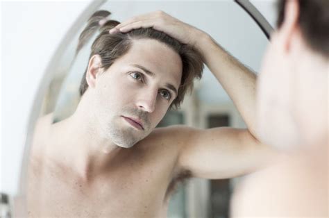 10 Signs You Will Go Bald How To Spot Them Before It’s