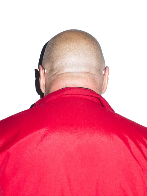 photographs   comprehensive study  bald white mens heads vice