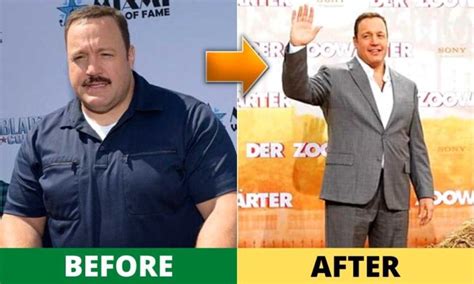 kevin james weight loss  diet surgery