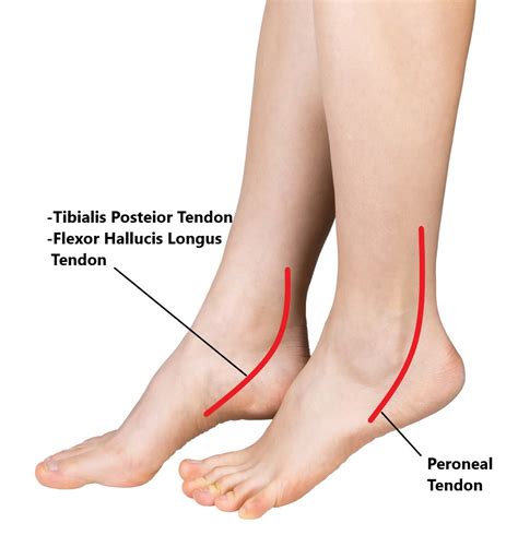 common ankle injuries  family physio